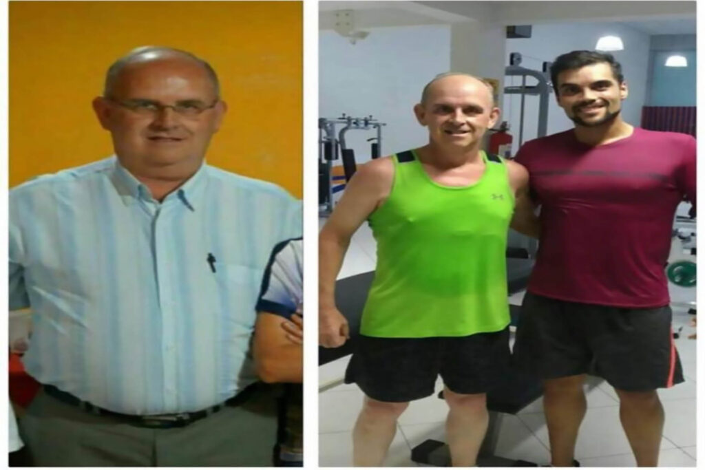 3 antes e depois 2