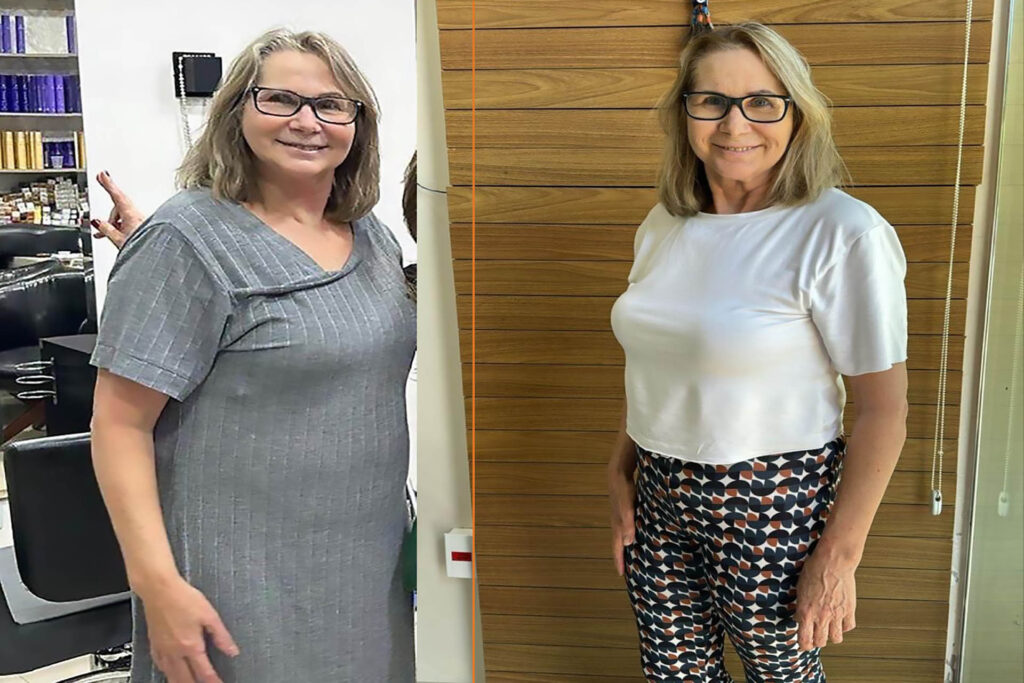 Antes e depois 2.3