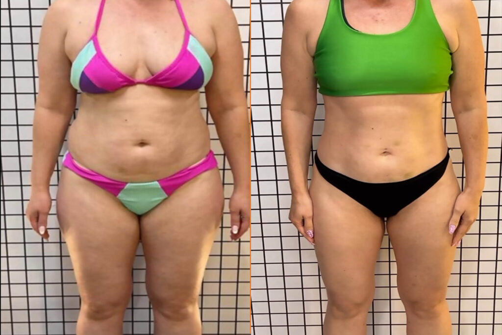 Antes e depois 4.2