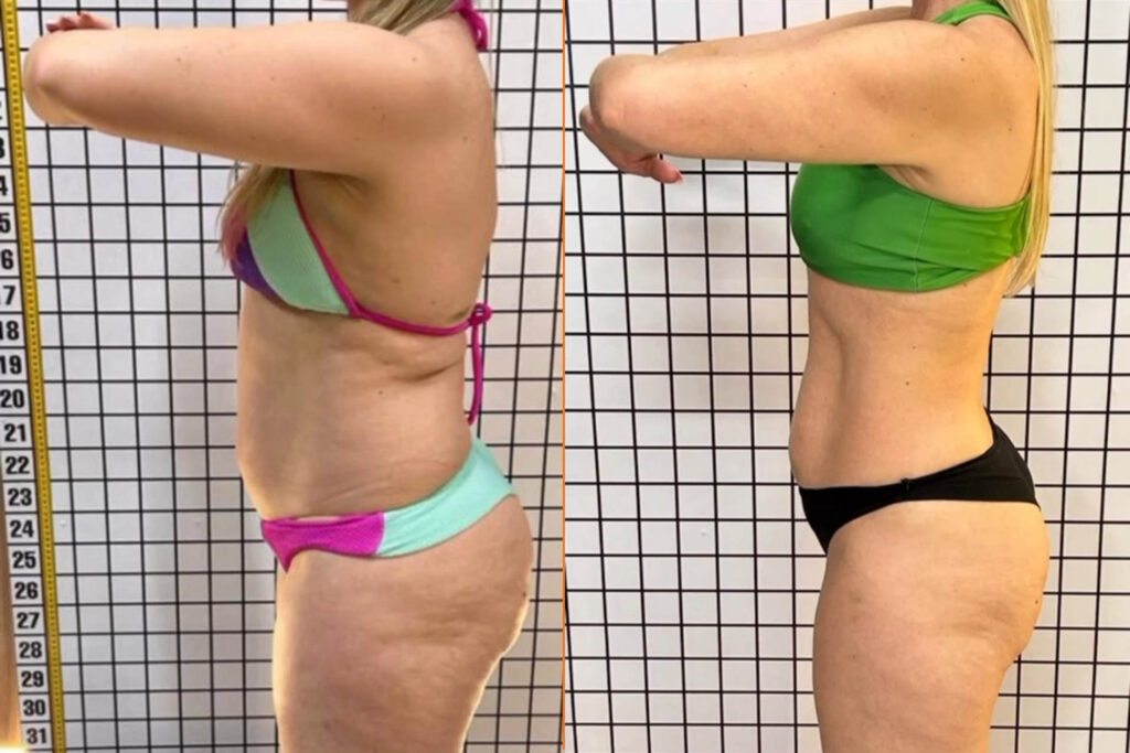 Antes e depois 5
