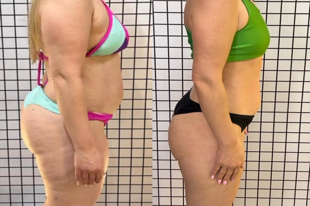antes e depois 6.2