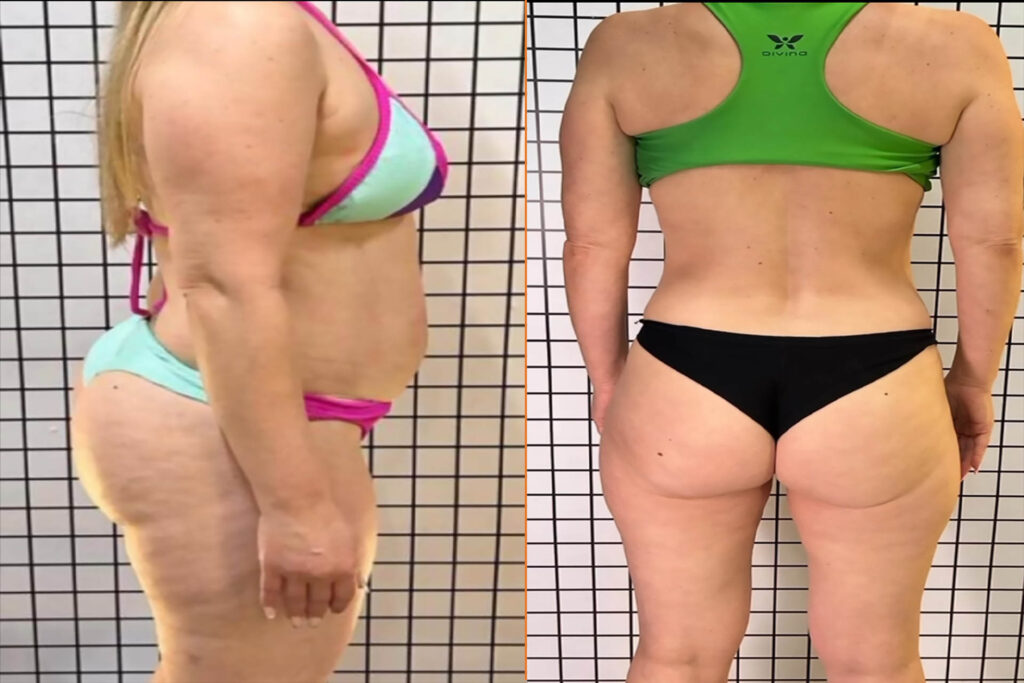 antes e depois 7
